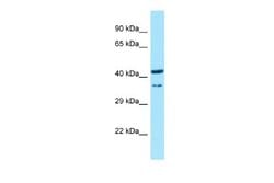 HOXD9 Rabbit anti-Rat, Polyclonal, Novus Biologicals 0.1ml; Unconjugated:Antibodies,